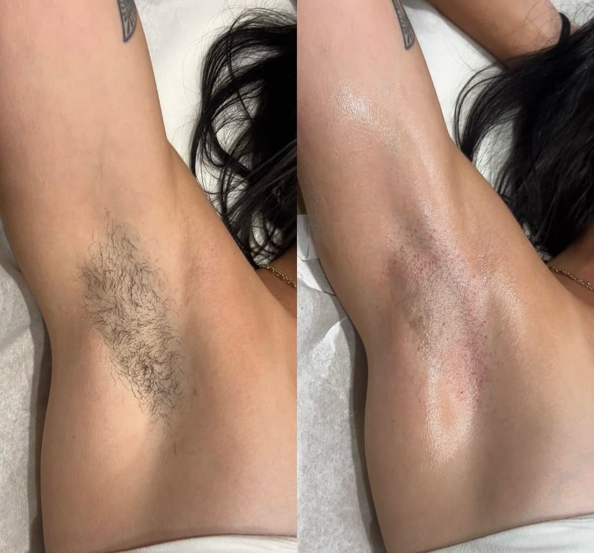 Under Arm Waxing