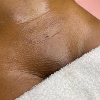 Soft Bikini Waxing